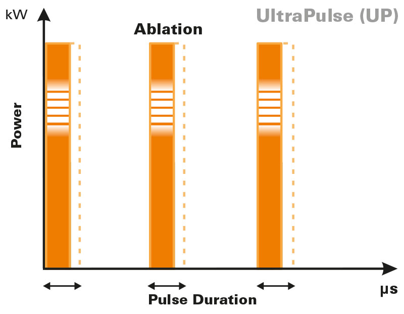 UltraPulse-laser frazionato-pulse-shapes